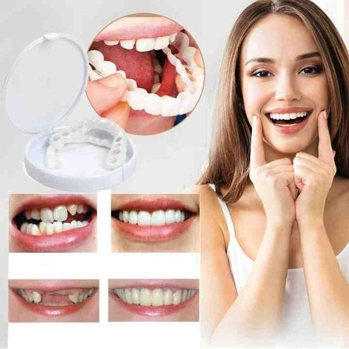 Snap-On Smile Veneers™ - Τελειοποιήστε αμέσως το χαμόγελό σας! - Αγοράστε 1 και πάρτε 1 δωρεάν